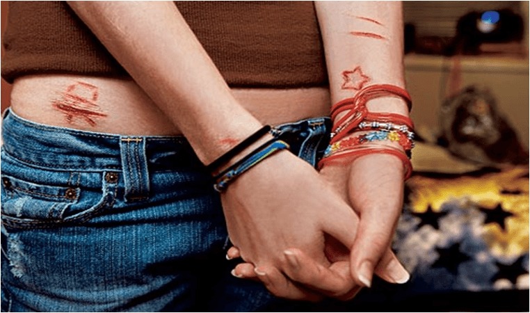 Automutilação, um distúrbio do comportamento